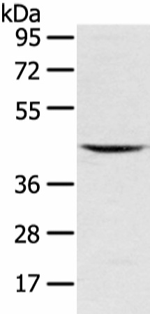 VSIG8 Polyclonal Antibody - small - 2
