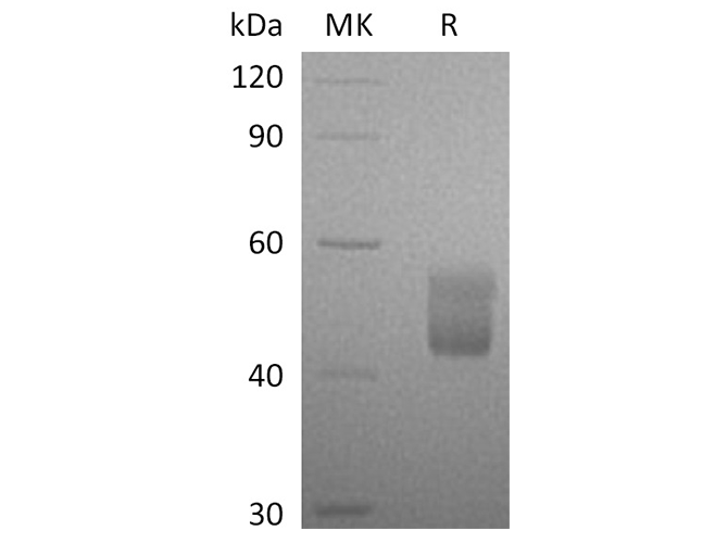 Recombinant Human CFHR3 Protein (His Tag) - small - 1