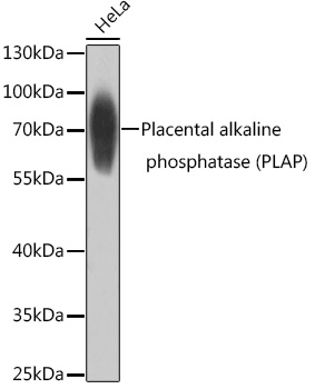 Placental alkaline phosphatase (PLAP) Polyclonal Antibody - 1