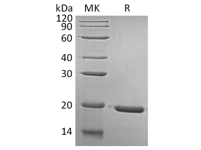 Recombinant Human GH1/Growth hormone 1 Protein - 1