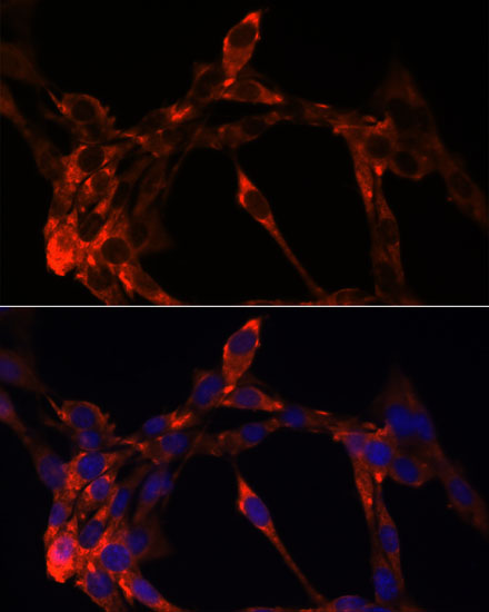 JAG1 Polyclonal Antibody - 1