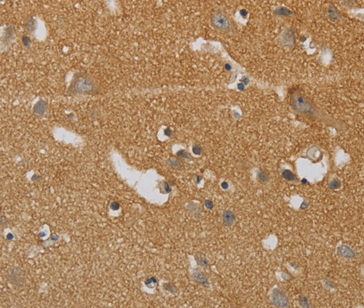 KIF4A Polyclonal Antibody - small - 1