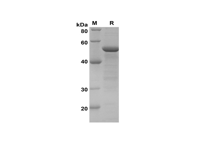 Recombinant Human ITGAX Protein(Sumo Tag) - 1