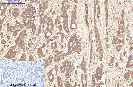 AQP4 Monoclonal Antibody - small - 2