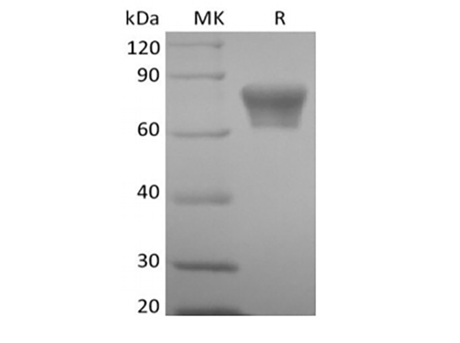 Recombinant Mouse TNF Receptor II/TNF RII/TNFRSF1B/CD120b (C-Fc) - 1
