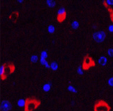 MAP2 Monoclonal Antibody - small - 2