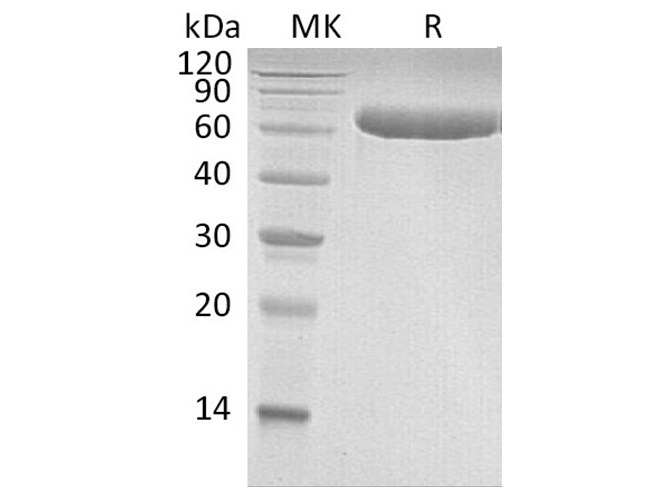 Recombinant Human LBP Protein (His Tag) - 1