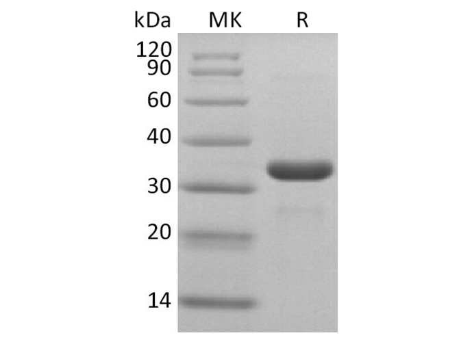 Recombinant SARS-CoV-2 3C-like Proteinase Protein (His Tag) - 1