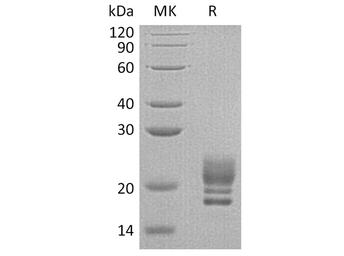 Recombinant Human COQ7 Protein (His Tag) - 1