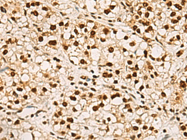 ELF5 Polyclonal Antibody - 1