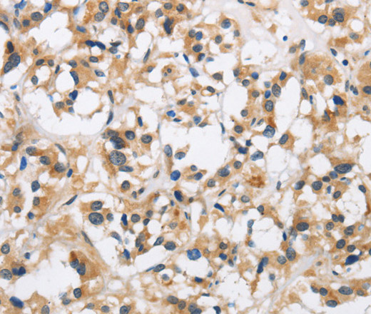 CKMT2 Polyclonal Antibody - small - 3