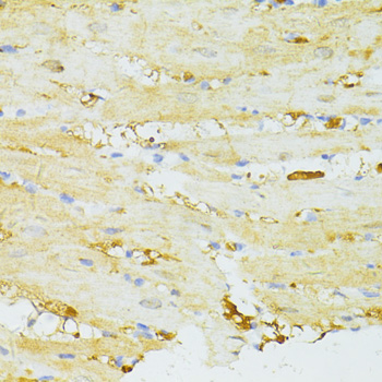 SIRT2 Polyclonal Antibody - 1