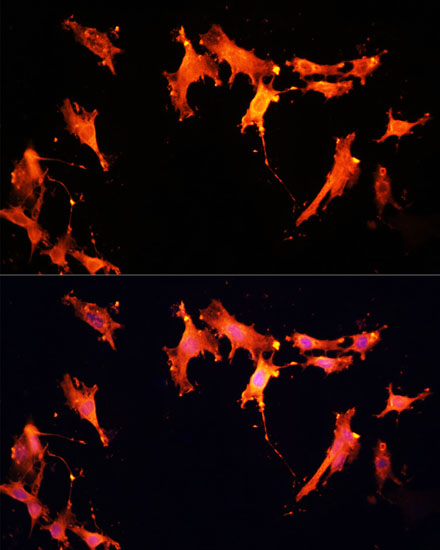 SIRT2 Polyclonal Antibody - small - 4