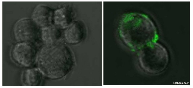 SARS-COV-2 Spike Monoclonal Antibody(2019-nCoV) - 1