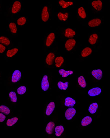 METTL3 Polyclonal Antibody - small - 5