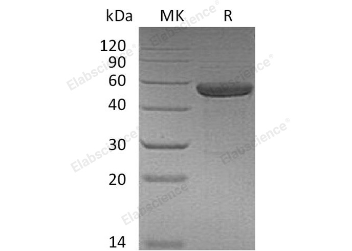 Recombinant Human IL15RA&IL15 Fusion Protein (Fc Tag) - 1