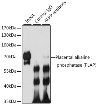 Placental alkaline phosphatase (PLAP) Polyclonal Antibody - 2