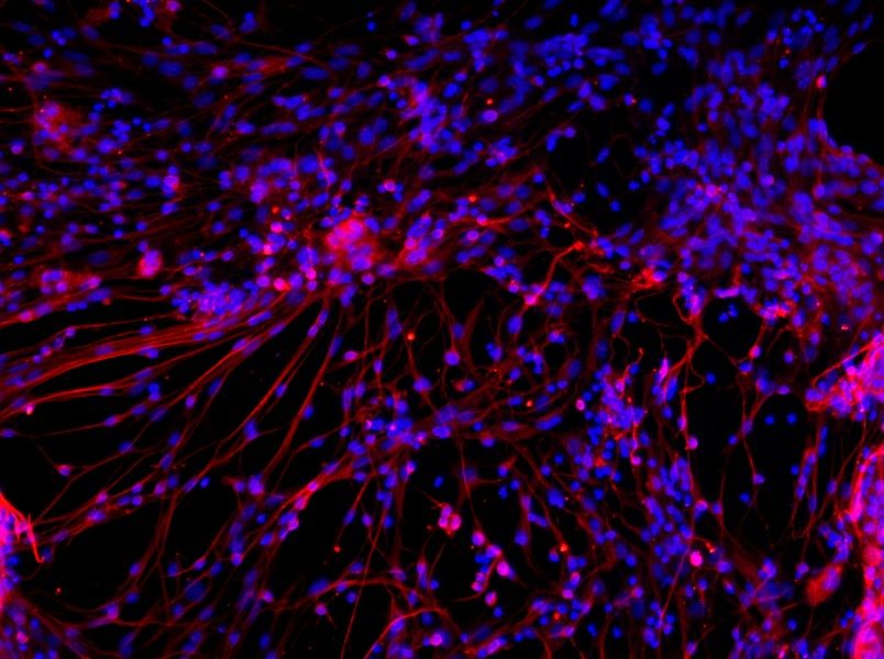 Mouse Cortical Neuron Complete Medium - 1