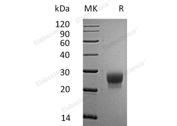 Recombinant Mouse G-CSF/CSF3 Protein (His Tag) - 1