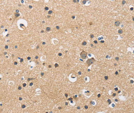 CKMT2 Polyclonal Antibody - small - 2