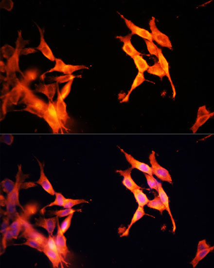 SIRT2 Polyclonal Antibody - small - 5