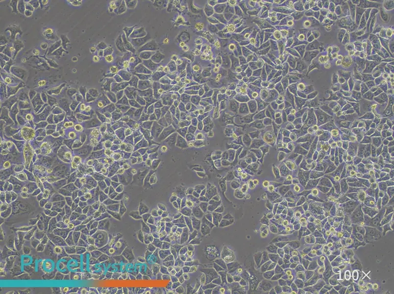 SK-BR-3 [SKBR3] Cell Complete Medium - 3