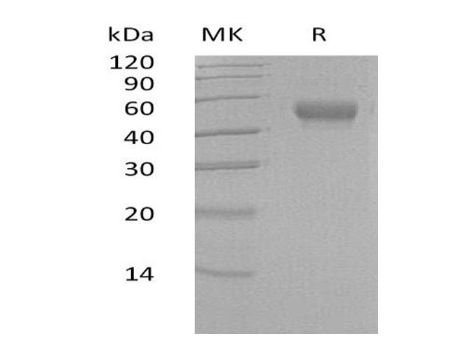Recombinant Human LRG1 Protein (His Tag) - 1
