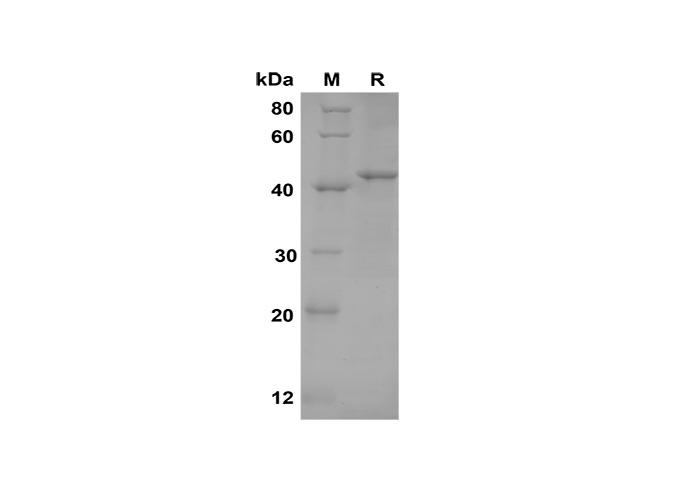 Recombinant Mouse TNF RI/TNFRSF1A Protein(Gst Tag) - 1