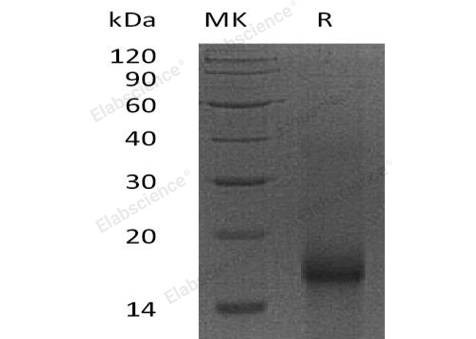 Recombinant Human Survivin/BIRC5 Protein - 1