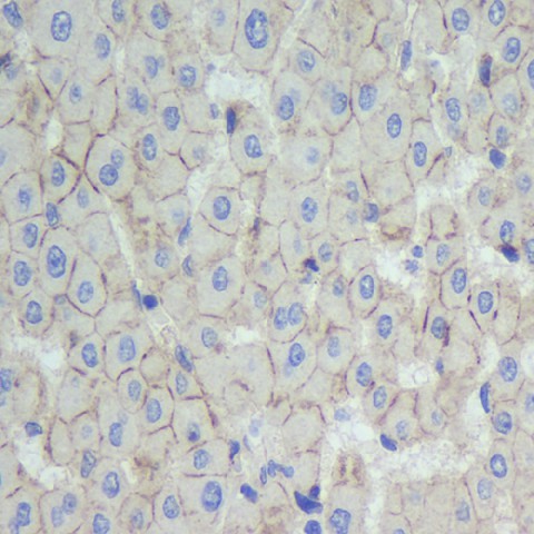 N-cadherin Polyclonal Antibody - 2