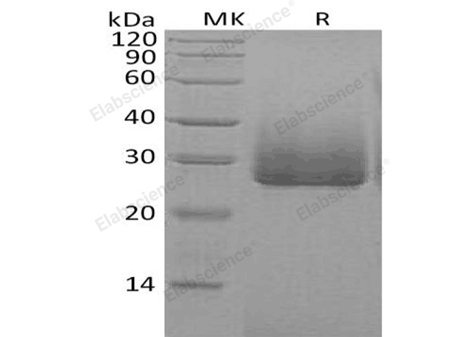 Recombinant Human Apolipoprotein D/ApoD Protein (His Tag) - 1