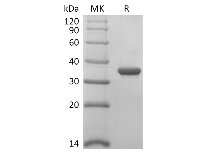 Recombinant SARS-CoV-2 Papain-Like Protease Protein - 1