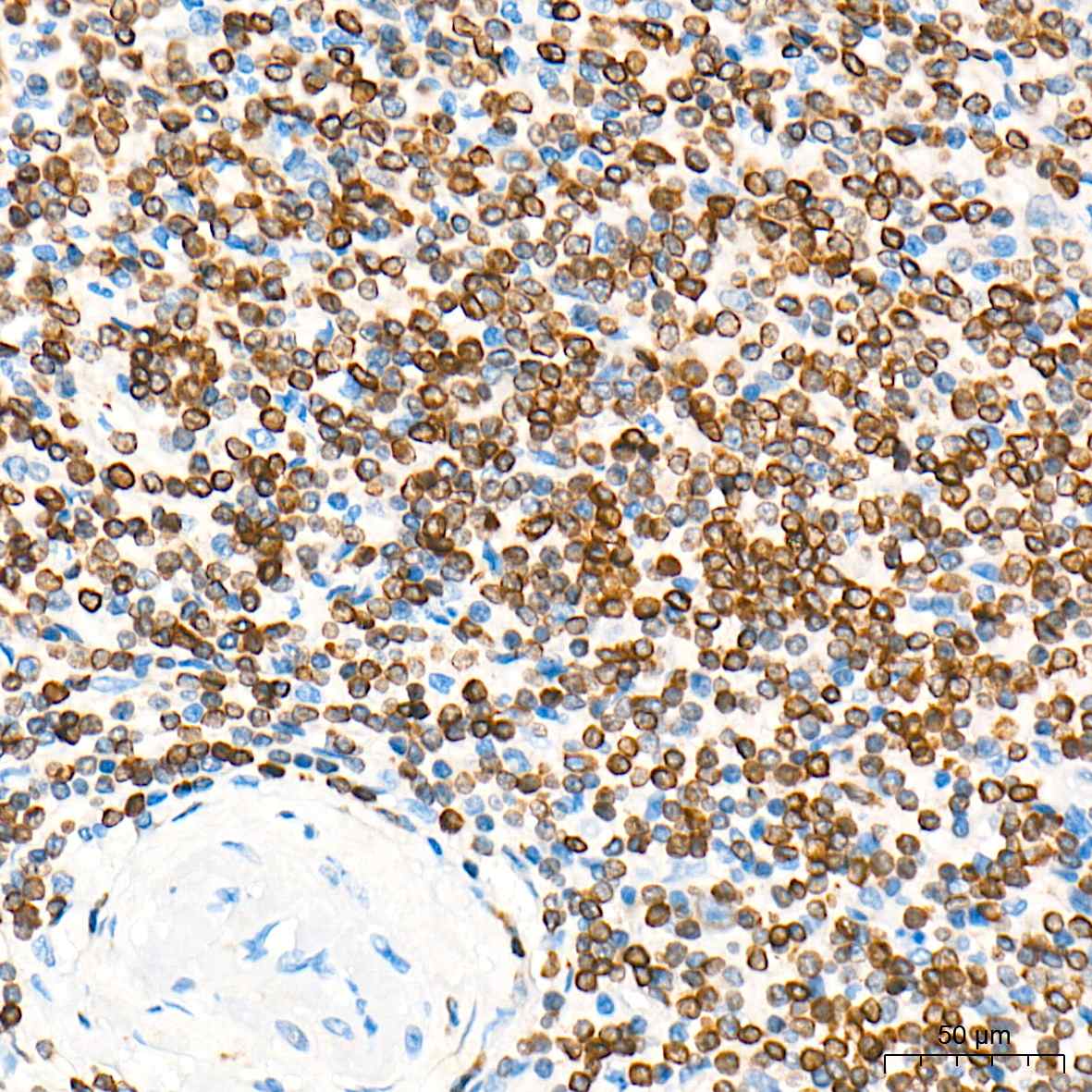 Bcl-2 Polyclonal Antibody - small - 5