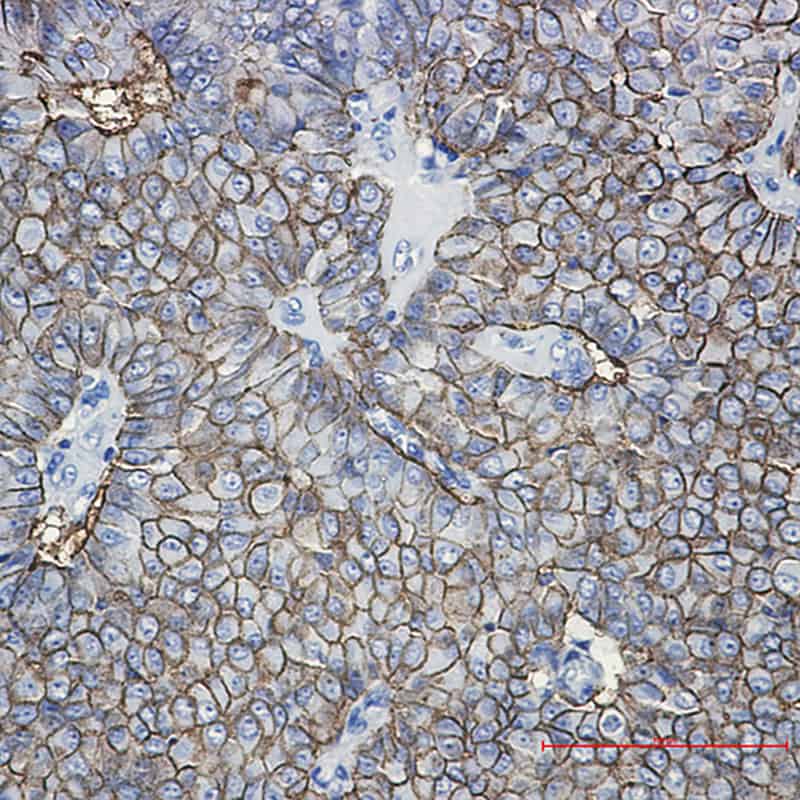 Recombinant EpCAM Monoclonal Antibody - 2