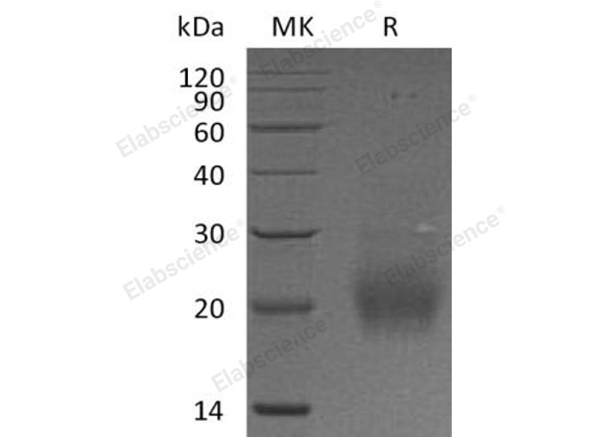 Recombinant Human Follitropin Subunit β/FSHB Protein (His Tag) - 1