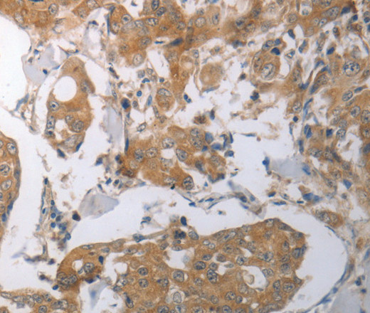 SHH Polyclonal Antibody - small - 1