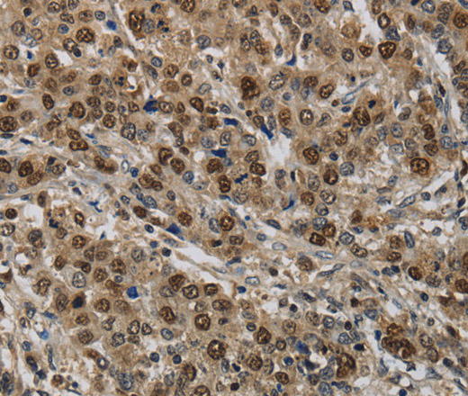 KIF4A Polyclonal Antibody - small - 2