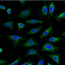 AQP4 Monoclonal Antibody - small - 3