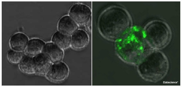 SARS-COV-2 Spike S1 Monoclonal Antibody(2019-nCoV) - 1