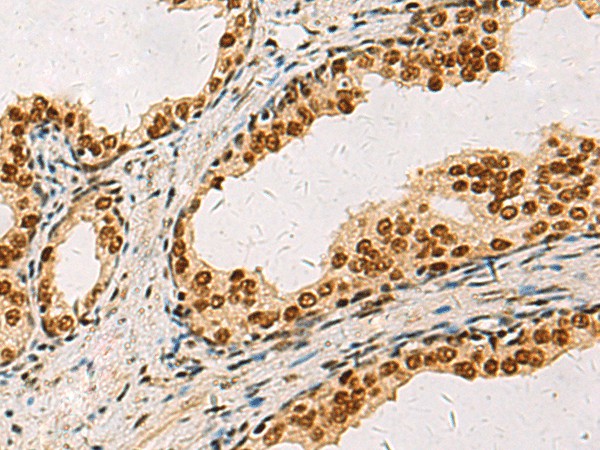 ELF5 Polyclonal Antibody - 2