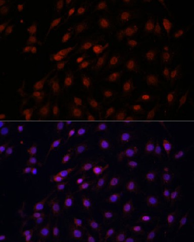 Bcl-2 Polyclonal Antibody - 1
