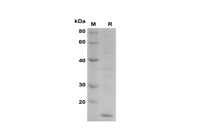 Recombinant Monkeypox virus A33R Protein (His Tag) - 1