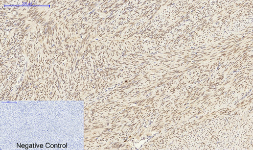 LMNA Polyclonal Antibody - small - 2