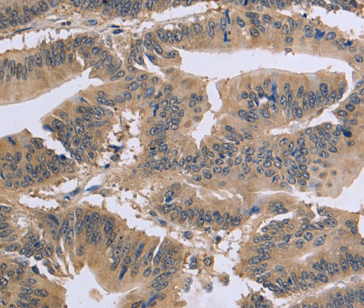 GSN Polyclonal Antibody - 2