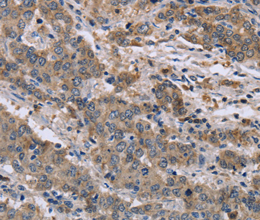 GSN Polyclonal Antibody - 1