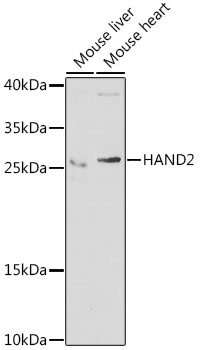 HAND2 Polyclonal Antibody - small - 1