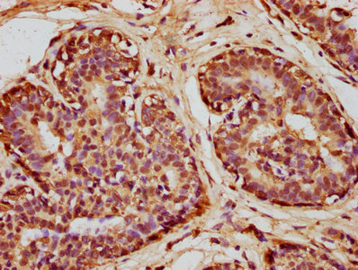 Immunohistochemistry(IHC) 1- SOD1 Antibody