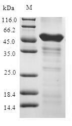 SDS-PAGE- Recombinant protein Human ABHD5