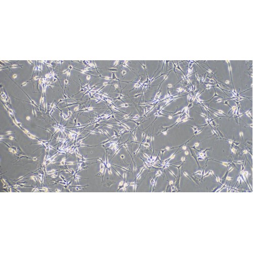 Rat Brain Stem Neuron Cells (BSNC) Morphology of BSNC (Optical microscope, 100X).