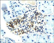 Adiponectin Receptor-1 staining in mouse pancreas. Paraffin-embedded mouse pancreas (top 5 panels) and rat placenta (bottom panel) are stained with Adiponectin Receptor-1 Antibody (Cat. No. 250476) used at 1:200 dilution. 